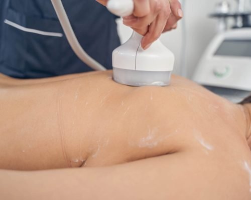 Close up of a hand probe of modern ultrasonic cavitation machine used on the back of a woman by unrecognizable beautician